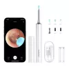 Ausų valiklis Bebird T15 Smart Visual White — vizualinis otoskopas ausų valymo įrenginys