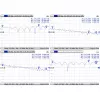 Kabelis Mmcx į RPSMA / ACMMCXRPSMA Mikrotik