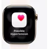 Išmanusis laikrodis Apple Watch Series 11 GPS + Cellular 42mm Jet Black Aluminium Case Black Sport Band S/M