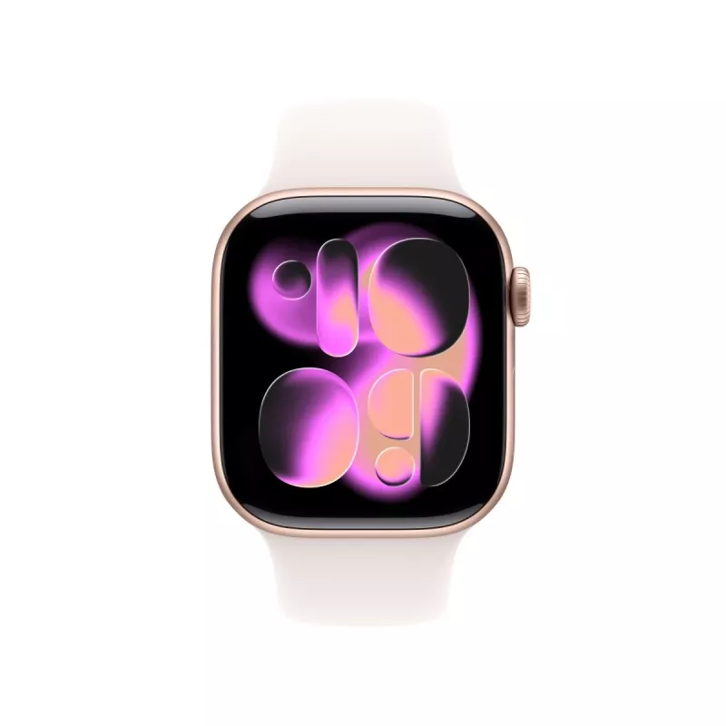 APPLE Watch Series 11 GPS + Cellular 42mm rožinio aukso aliuminio korpusas su šviesiai rožiniu sportiniu dirželiu S/M