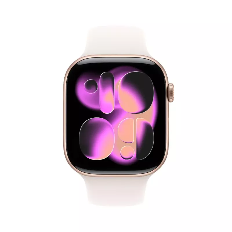 Išmanusis laikrodis Apple Watch Series 11 GPS + Cellular 46mm rožinio aukso aliuminio korpusas, šviesiai rožinis sportinis dirželis M/L