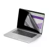 StarTech.com 16 colių MacBook Pro 21/23 nešiojamojo kompiuterio privatumo ekranas, nuimamas ir apverčiamas apsaugos nuo akinimo privatumo filtras, magnetinis nešiojamojo kompiuterio ekrano apsauga su 51 % mėlynos šviesos sumažinimu