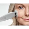 HoMedics MD-1000-EU2 odos priežiūros prietaisas Odos vakuuminė mikrodermabrazija Balta