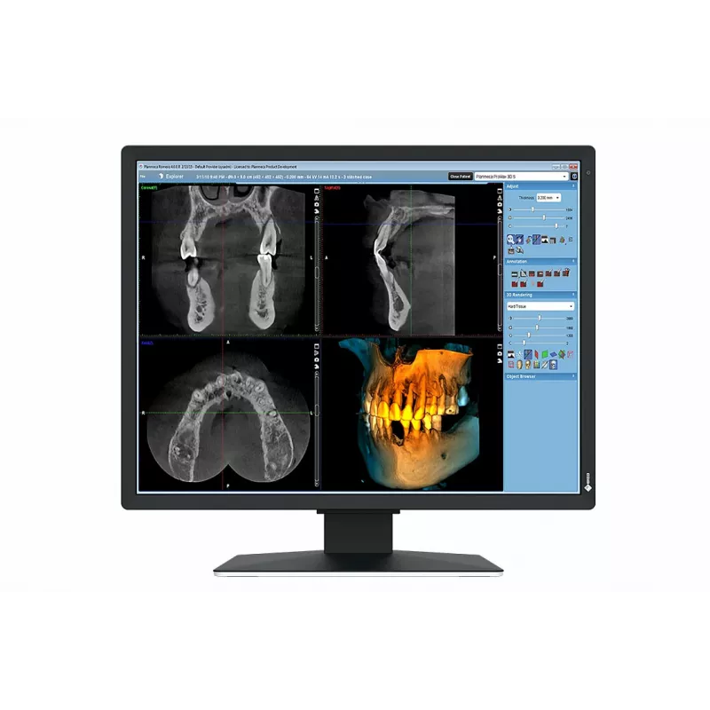 EIZO RadiForce MX217-SB kompiuterio monitorius 53,3 cm (21 col.) 1200 x 1600 pikselių UXGA LCD juodas