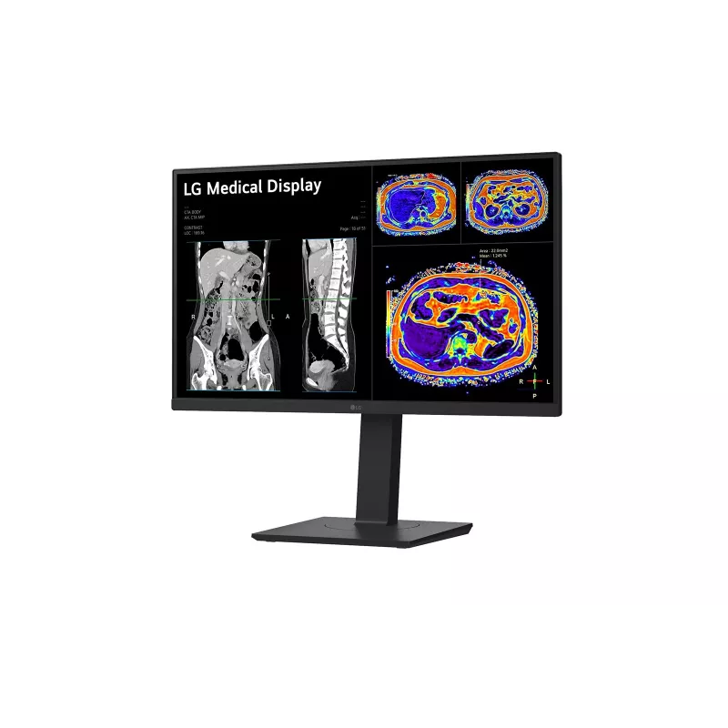 LG 27HS713C-B kompiuterio monitorius 68,6 cm (27 coliai) 3840 x 2160 pikselių 4K Ultra HD LED juodas