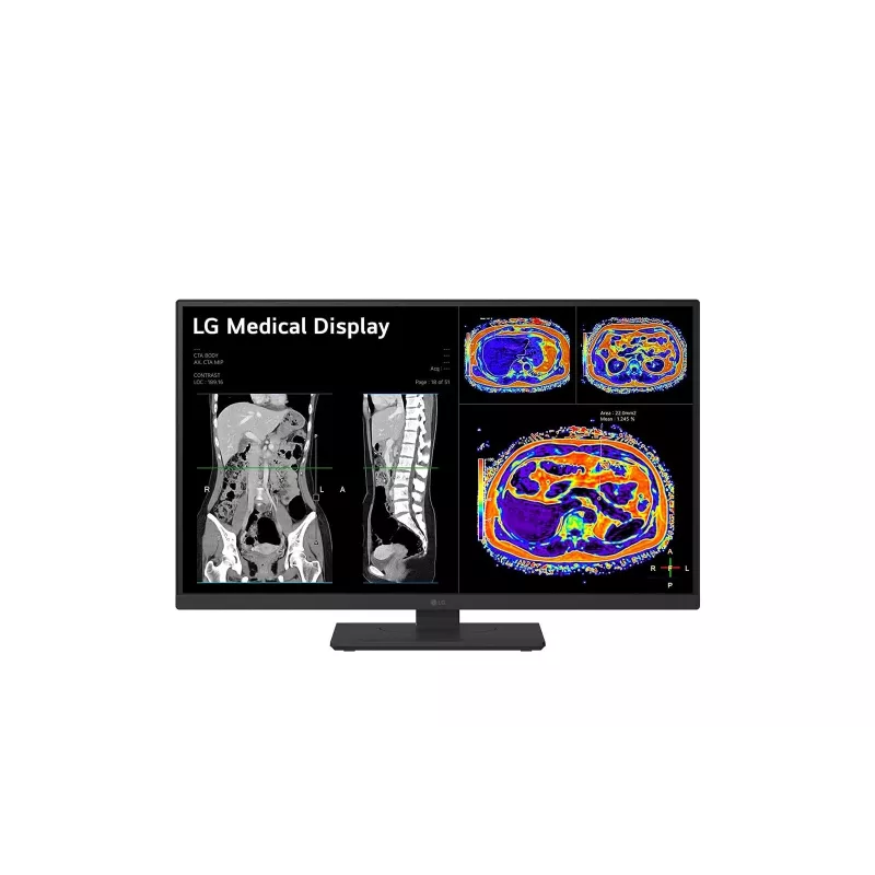 LG 27HS713C-B kompiuterio monitorius 68,6 cm (27 coliai) 3840 x 2160 pikselių 4K Ultra HD LED juodas