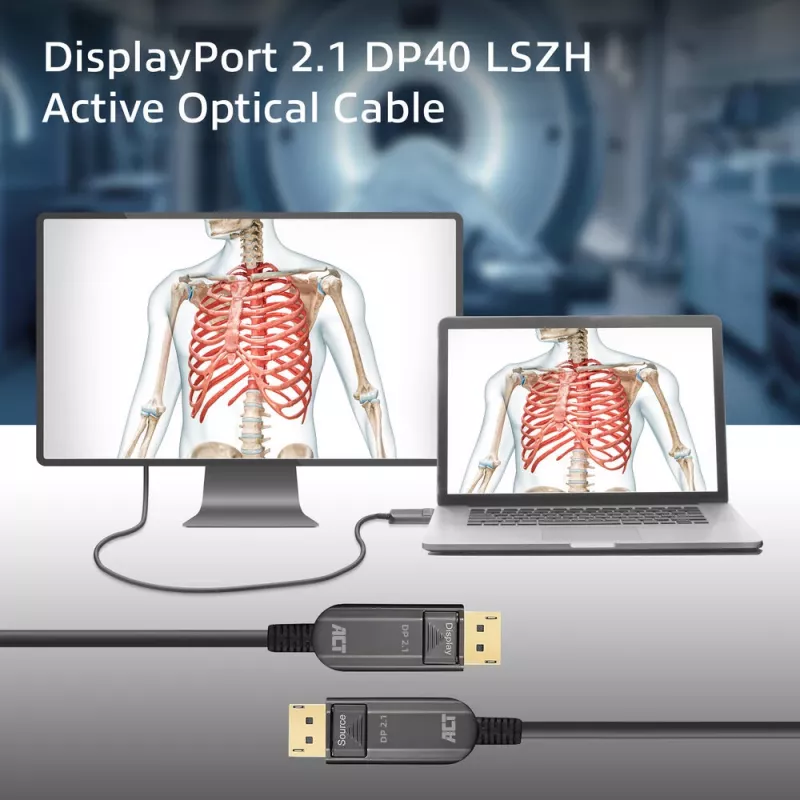 ACT AK4172 DisplayPort laidas 20 m Juodas