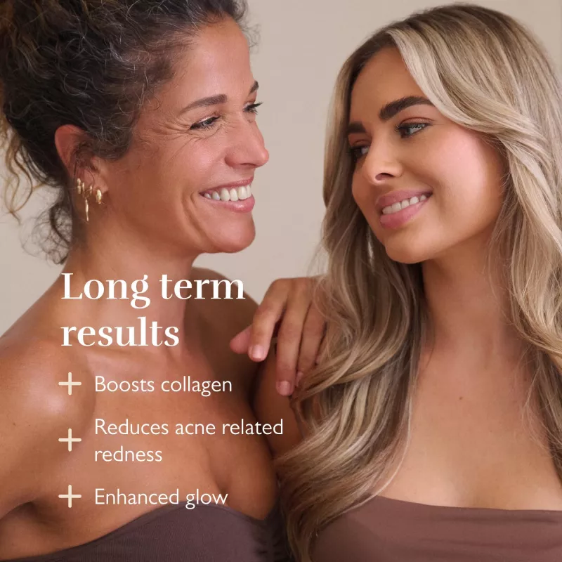 Silk'n LED Face Mask Pro FLMP1PE1001 – Anti-Aging ir spuogų LED šviesos terapijos kaukė
