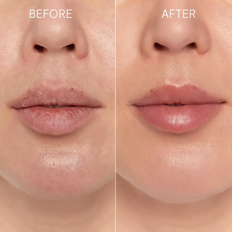 GLOV Scrubex Lip Exfoliating Mitt - 2 vnt. | Švelnus mikropluošto lūpų šveitiklis lygioms lūpoms