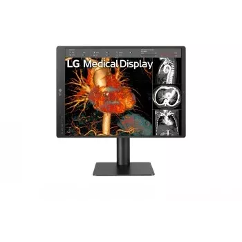 LG 21.3 inch 3MP IPS diagnostinis monitorius 21HQ513D-M