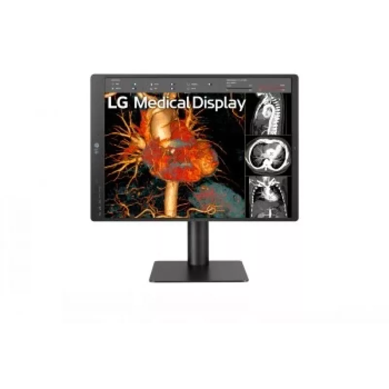 LG 21.3 inch 3MP IPS diagnostinis monitorius 21HQ513D-M